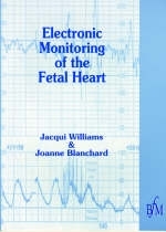 Electronic Monitoring of Fetal Heart - Jacqui Williams