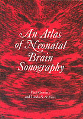 An Atlas of Neonatal Brain Sonography - Paul Govaert, Linda S. de Vries