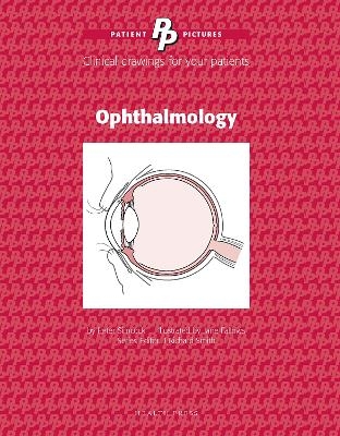 Patient Pictures: Ophthalmology - Peter Simcock