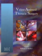 Video-Assisted Thoracic Surgery - William S Walker