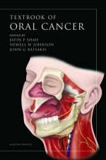 Oral Cancer - 