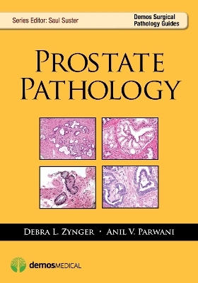 Prostate Pathology - Debra Zynger, Anil V. Parwani