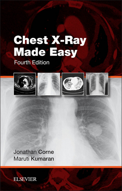 Chest X-Ray Made Easy E-Book -  Jonathan Corne,  Maruti Kumaran