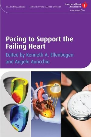 Pacing to Support the Failing Heart - 