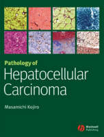 Pathology of Hepatocellular Carcinoma - Masamichi Kojiro