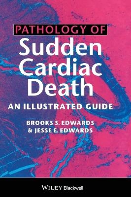 Pathology of Sudden Cardiac Death - Brooks S. Edwards, Jesse E. Edwards