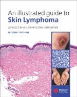 An Illustrated Guide to Skin Lymphoma - Lorenzo Cerroni, Kevin Gatter, Helmut Kerl