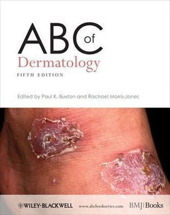 ABC of Dermatology - 