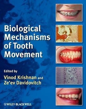 Biological Mechanisms of Tooth Movement - 