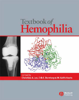 Textbook of Hemophilia - 