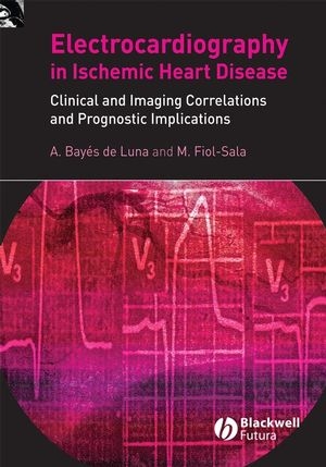 Electrocardiography in Ischemic Heart Disease - Antoni Bayés de Luna, Miquel Fiol–Sala