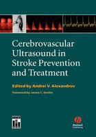 Cerebrovascular Ultrasound in Stroke Prevention and Treatment - 