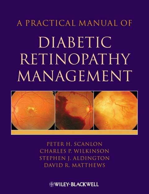 A Practical Manual of Diabetic Retinopathy Management - Peter Scanlon, Stephen Aldington, Charles Wilkinson, David Matthews