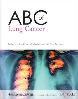 ABC of Lung Cancer - 