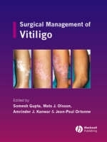 Surgical Management of Vitiligo - 