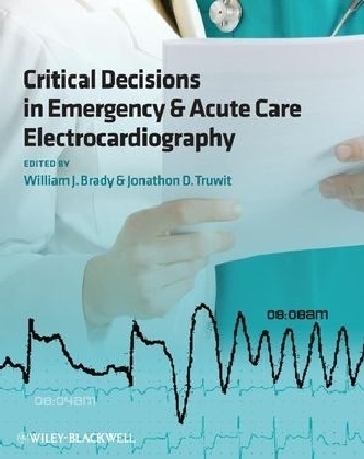 Critical Decisions in Emergency and Acute Care Electrocardiography - 