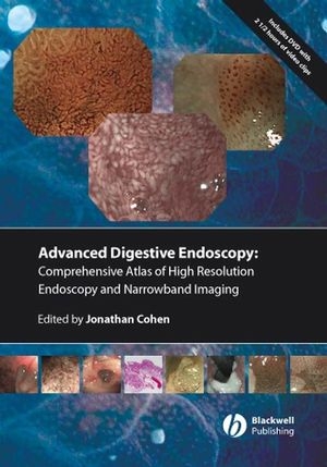 Comprehensive Atlas of High Resolution Endoscopy and Narrowband Imaging - 