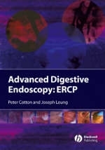 Advanced Digestive Endoscopy - 