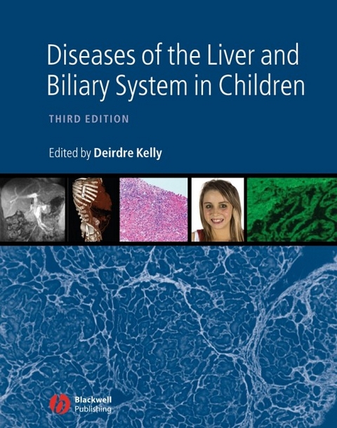 Diseases of the Liver and Biliary System in Children - D Kelly