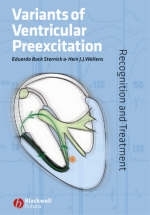 Variants of Ventricular Preexcitation - Eduardo Back Sternick, Hein J. J. Wellens