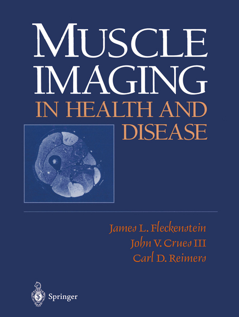 Muscle Imaging in Health and Disease - 