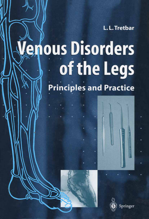 Venous Disorders of the Legs - Lawrence L. Tretbar