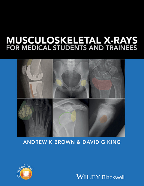 Musculoskeletal X-Rays for Medical Students and Trainees - Andrew Brown, David G. King