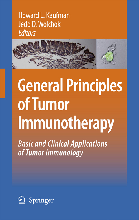 General Principles of Tumor Immunotherapy - 