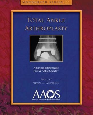 Total Ankle Arthroplasty - 