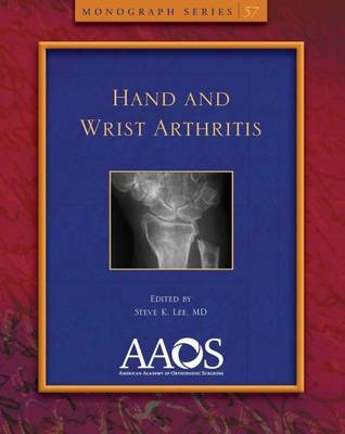 Hand and Wrist Arthritis - 