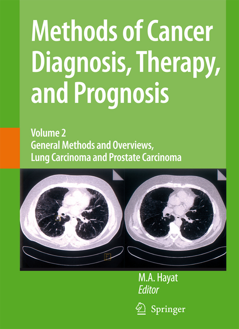 Methods of Cancer Diagnosis, Therapy and Prognosis - 