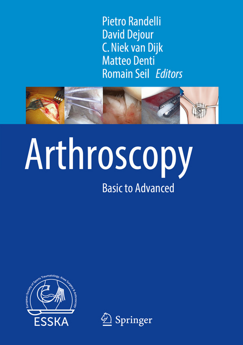 Arthroscopy - 