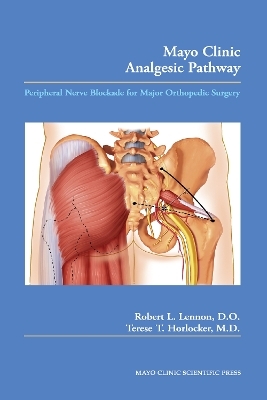 Mayo Clinic Analgesic Pathway - Robert L. Lennon, Terese T. Horlocker