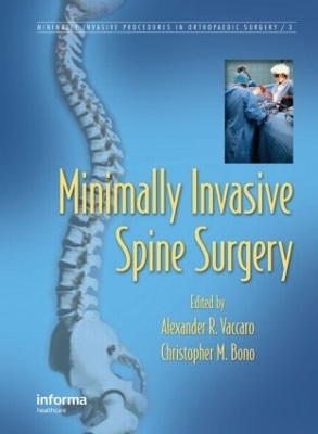 Minimally Invasive Spine Surgery - 