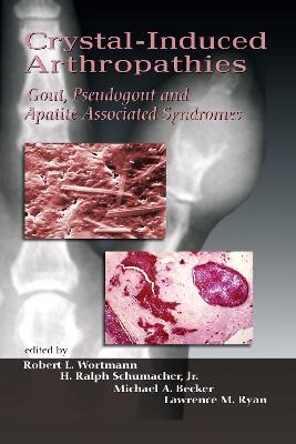 Crystal-Induced Arthropathies - 