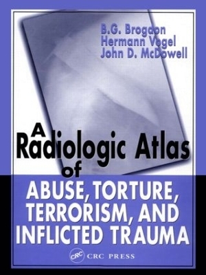 A Radiologic Atlas of Abuse, Torture, Terrorism, and Inflicted Trauma - B. G. Brogdon, Hermann Vogel, John D. McDowell