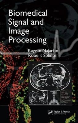 Biomedical Signal and Image Processing - Kayvan Najarian, Robert Splinter