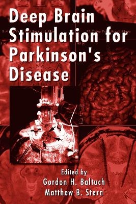 Deep Brain Stimulation for Parkinson's Disease - 