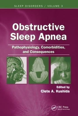 Obstructive Sleep Apnea: Pathophysiology, Comorbidities and Consequences - 