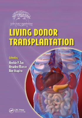 Living Donor Transplantation - 