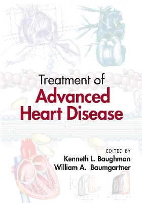 Treatment of Advanced Heart Disease - 