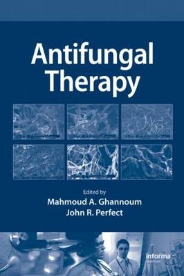 Antifungal Therapy