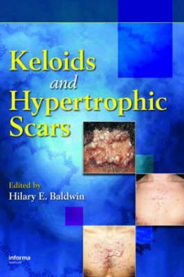 Keloids and Hypertrophic Scars - Hilary E. Baldwin