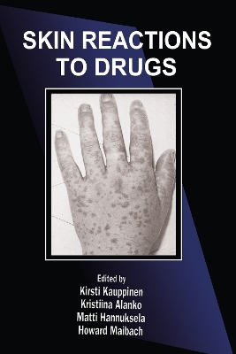 Skin Reactions to Drugs - 