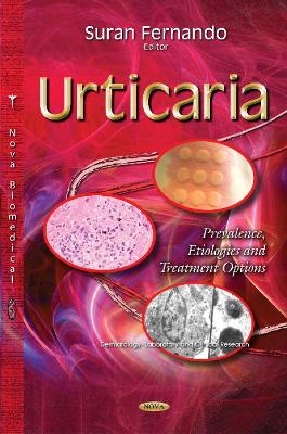 Urticaria - 