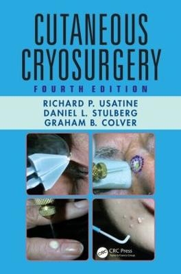 Cutaneous Cryosurgery - Richard P. Usatine, Daniel L. Stulberg, Graham B. Colver