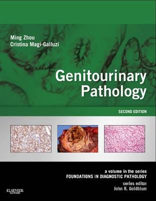 Genitourinary Pathology E-Book - Mr Ming Zhou, Cristina Magi-Galluzzi