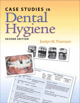 Case Studies in Dental Hygiene - Evelyn Thomson, Debbie Bauman