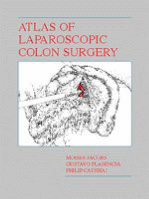 Atlas of Laparoscopic Colon Surgery - Moises Jacobs, Gustavo Plascencia, Philip F. Caushaj