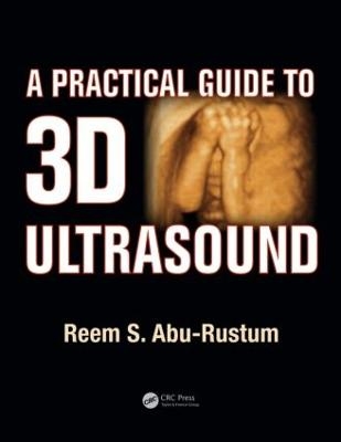 A Practical Guide to 3D Ultrasound - Reem S. Abu-Rustum